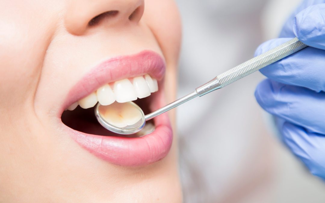 Discover Your Perfect Smile: Professional Teeth Whitening in Augusta, GA